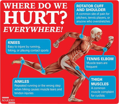 Arofen Plus Tube Of 30gm Gel