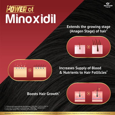 Mankind Chekfall Minoxidil 5% | Hair Growth Serum | Alcohol Free | Prevents Hair Loss | 60 Ml