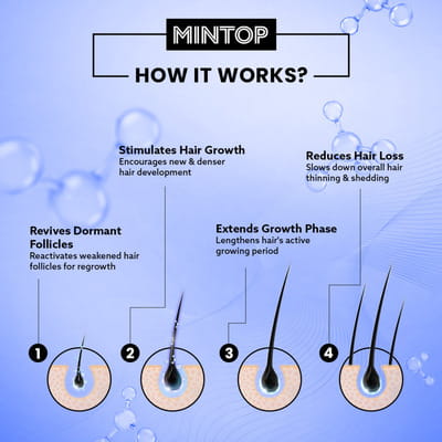 Mintop Forte 10% Bottle Of 120ml Solution
