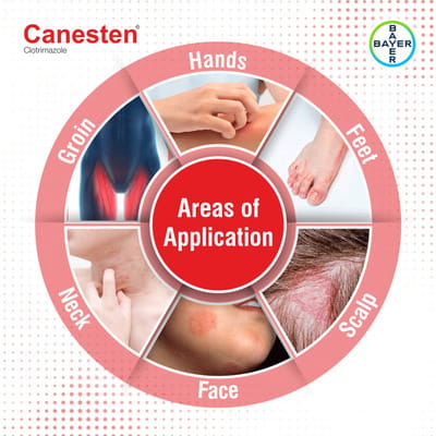 Canesten Bottle Of 30ml Solution
