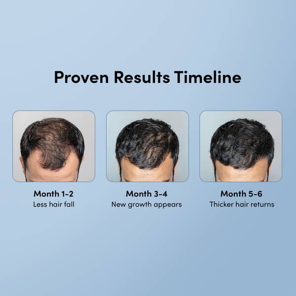 Man Matters Minoxifin Advance Bottle Of 60Ml Solution