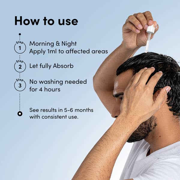 Man Matters Minoxifin Advance Bottle Of 60Ml Solution
